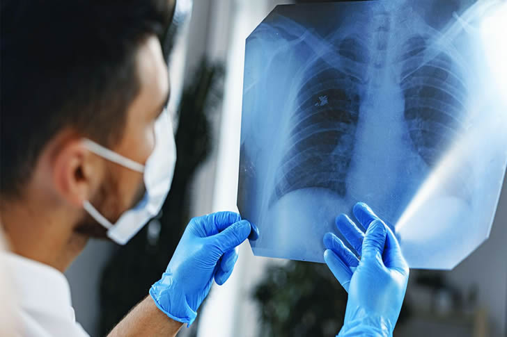 Minimizing Risks: Avoiding Smoking and Reducing Radon Exposure